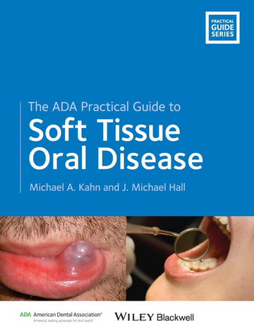 The ADA Practical Guide to Soft Tissue Oral Disease 1st Edition